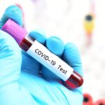 Serološki test na virus COVID-19