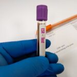 Sedimentacija eritrocita