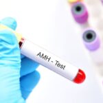 AMH Hormon (Antimilerov hormon)