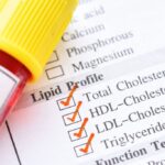 Lipidni status